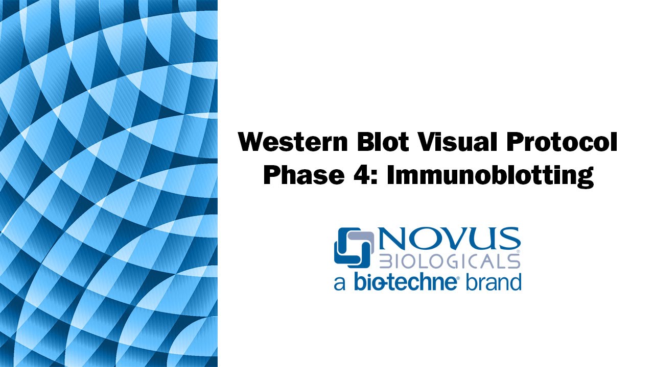 immunoblotting vs western blot