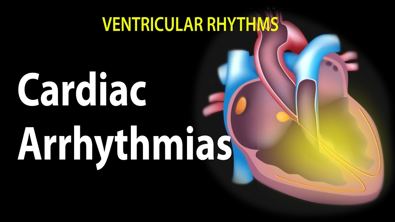 心律失常 Cardiac Arrhythmias Voicetube 看影片學英語