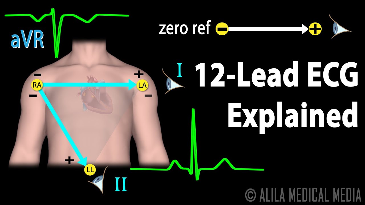 12-12-lead-ecg-explained-animation-voicetube